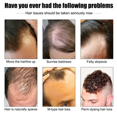 Hair Growth Nutrition Essence
