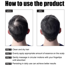 Hair Growth Nutrition Essence