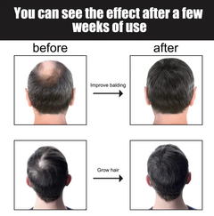 Hair Growth Nutrition Essence